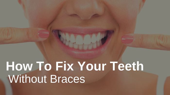 How To Fix Your Teeth Without Braces